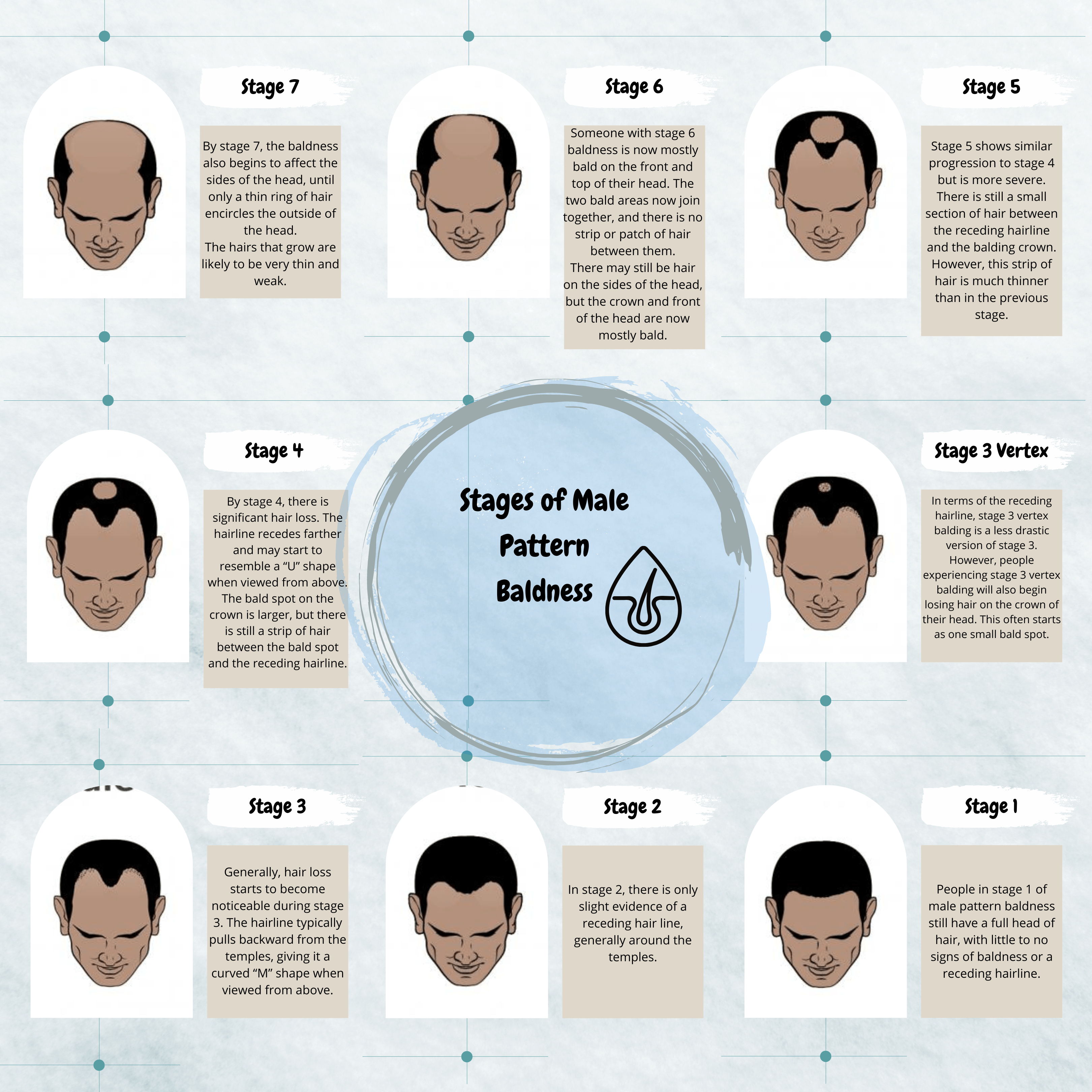 What are the Stages of Hair Loss? - The Norwood Scale